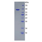 SDS-PAGE analysis of Human Zymogen Granule Protein 16 Homolog B (ZG16B) Protein.