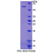 SDS-PAGE analysis of SHC-Transforming Protein 3 Protein.