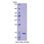 SDS-PAGE analysis of Prolactin Induced Protein.