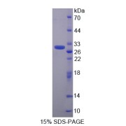SDS-PAGE analysis of Calcyclin Binding Protein.