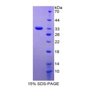 SDS-PAGE analysis of Growth Associated Protein 43 Protein.