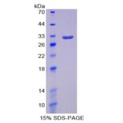 SDS-PAGE analysis of Signal Regulatory Protein alpha Protein.