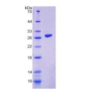 abx165987