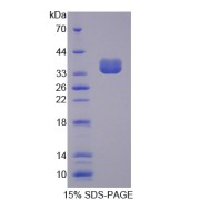 SDS-PAGE analysis of Valosin Containing Protein.