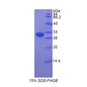 SDS-PAGE analysis of Haptoglobin Related Protein.
