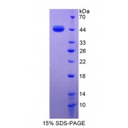 SDS-PAGE analysis of S100A7 Protein.