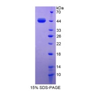 SDS-PAGE analysis of S100A7 Protein.