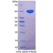 SDS-PAGE analysis of S100A11 Protein.