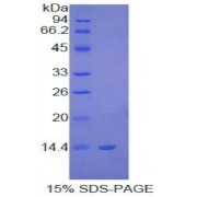 SDS-PAGE analysis of S100B Protein.