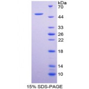 SDS-PAGE analysis of recombinant Human Surfactant Associated Protein C Protein.