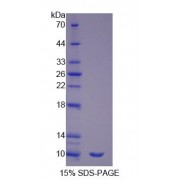 SDS-PAGE analysis of Surfactant Associated Protein G Protein.