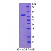 SDS-PAGE analysis of recombinant Rat APBB3 Protein.