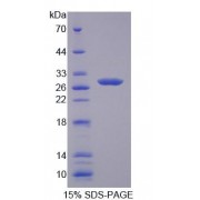 SDS-PAGE analysis of Cysteine Rich Secretory Protein 2 Protein.