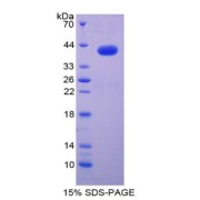 SDS-PAGE analysis of CCL3 Protein.