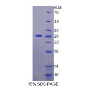 SDS-PAGE analysis of Mab21 Domain Containing Protein 1 Protein.