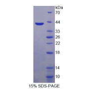 SDS-PAGE analysis of CCL4 Protein.