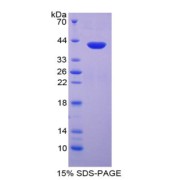 SDS-PAGE analysis of CCL3 Protein.