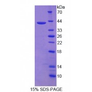 SDS-PAGE analysis of Nuclear Receptor Related Protein 1 Protein.