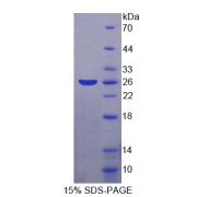 SDS-PAGE analysis of SKP1 Protein.
