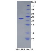 SDS-PAGE analysis of recombinant Human Peptidoglycan Recognition Protein 1 (PGLYRP1).