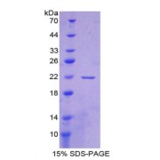 SDS-PAGE analysis of Apolipoprotein A1 Binding Protein.