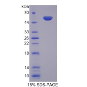SDS-PAGE analysis of LBP Protein.