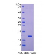 SDS-PAGE analysis of REG4 Protein.