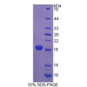 SDS-PAGE analysis of Cellular Retinoic Acid Binding Protein 2 Protein.