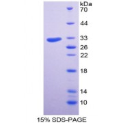 SDS-PAGE analysis of Structure Specific Recognition Protein 1 Protein.