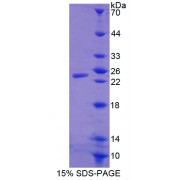 SDS-PAGE analysis of WAP Four Disulfide Core Domain Protein 1 Protein.