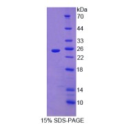abx166179