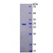 SDS-PAGE analysis of Phosphatidylethanolamine Binding Protein 1 Protein.