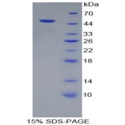 abx166187