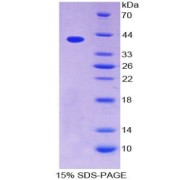 SDS-PAGE analysis of CCL4L1 Protein.