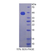 SDS-PAGE analysis of recombinant Human IGF2BP3 Protein.