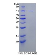 SDS-PAGE analysis of recombinant Mouse Latent-Transforming Growth Factor Beta-Binding Protein 1 (LTBP1) Protein.
