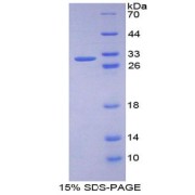 SDS-PAGE analysis of Kinase D1 Protein.
