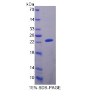 SDS-PAGE analysis of alpha 1-B-GlycoProtein.