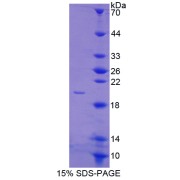 SDS-PAGE analysis of Annexin A4 Protein.