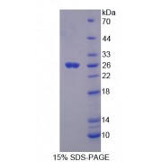 SDS-PAGE analysis of recombinant Cow Thrombospondin 1 Protein.