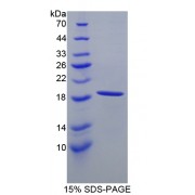 SDS-PAGE analysis of Hemoglobin alpha 1 Protein.