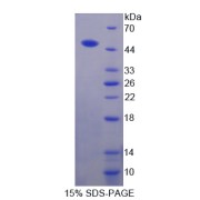 SDS-PAGE analysis of Aspartate Aminotransferase Protein.