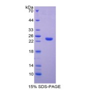 SDS-PAGE analysis of TIMP4 Protein.