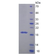 SDS-PAGE analysis of Mucin 5B Protein.