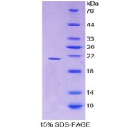 SDS-PAGE analysis of Interferon gamma Protein.