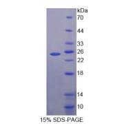 SDS-PAGE analysis of Somatotropin Protein.