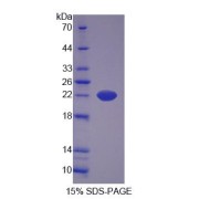 SDS-PAGE analysis of Apolipoprotein M Protein.