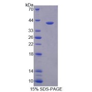 SDS-PAGE analysis of recombinant Chicken TNF alpha Protein.