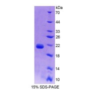 SDS-PAGE analysis of Calmodulin-1 Protein.