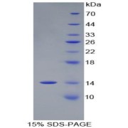 SDS-PAGE analysis of Procalcitonin Protein.